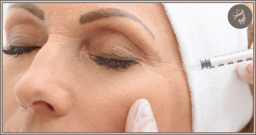 مراقبت های بعد از تزریق ژل زیر چشم 