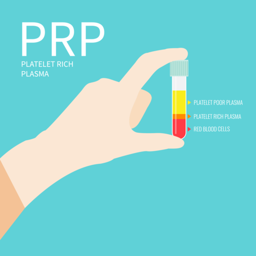 پلاسمانی غنی شده از پلاکت