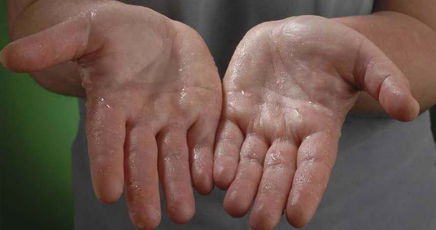درمان عرق کف دست با لیزر